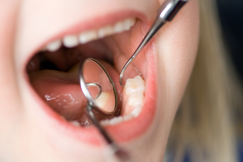 L'actuació està destinada a persones que pateixen malalties buco-dentals.