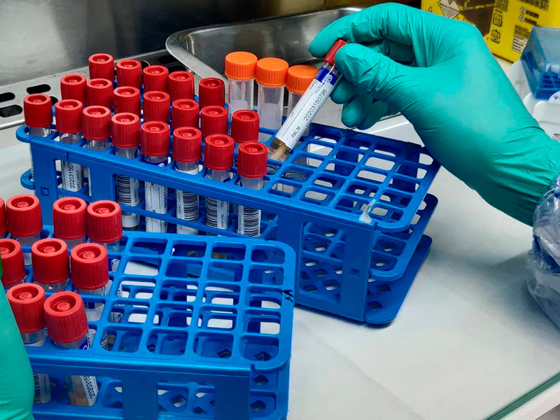 L'hospital de Palamós va fer durant el mes d'octubre més de 7.700 proves PCR. (Foto: SSIBE).