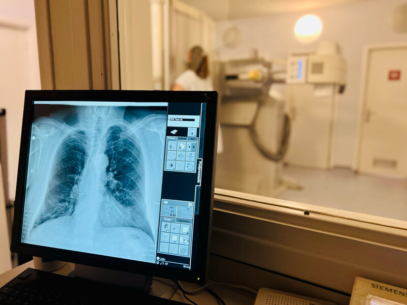 Les es imatges de proves realitzades a l’Hospital de Palamós es podran descarregar i accedir a través d’un nou portal. (Foto: SSIBE).